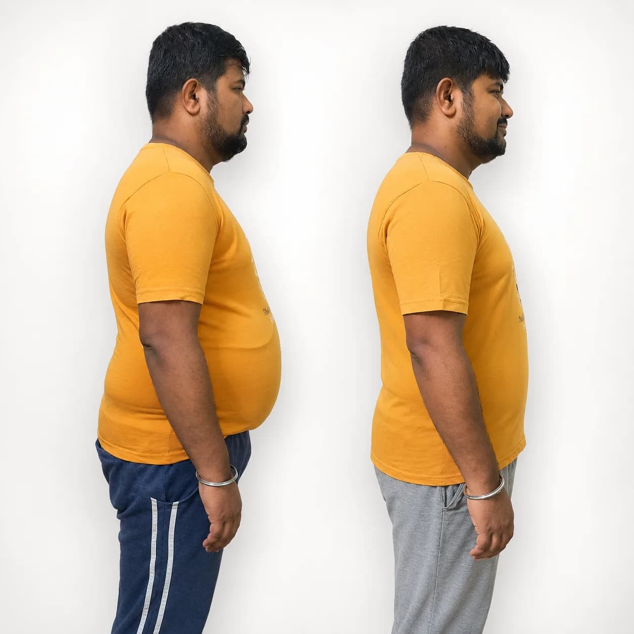 Achyutha Gubbi — 10 kg Weight Loss