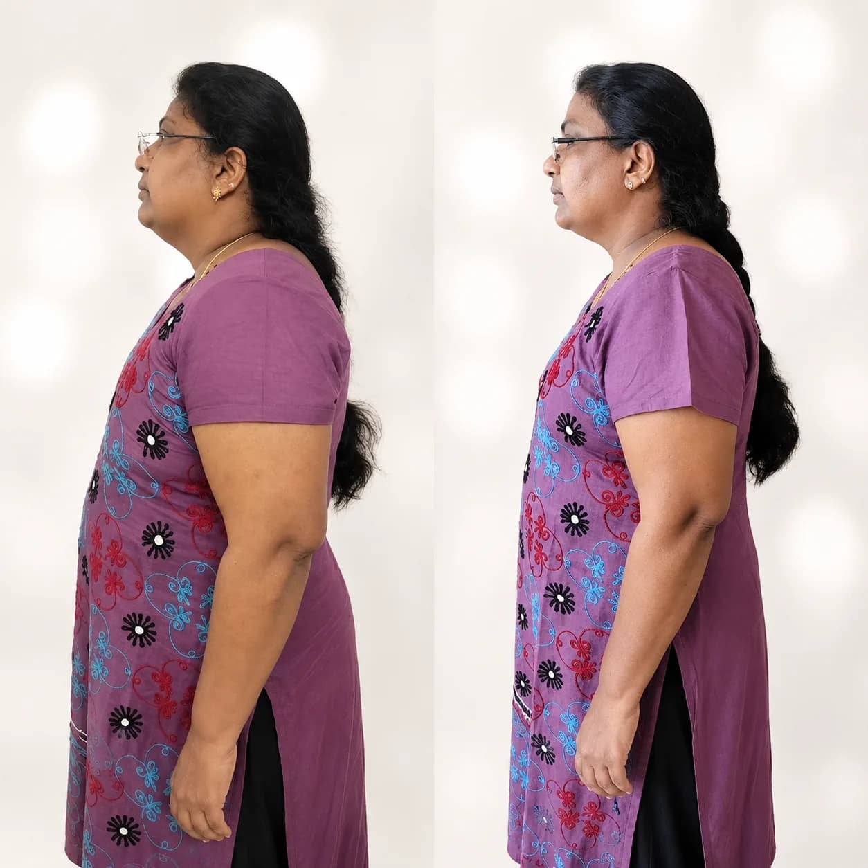 Sreeja Hari — 10 kg Weight Loss